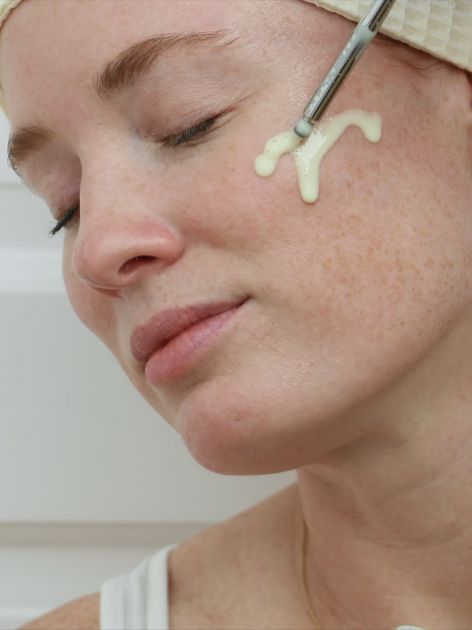 Šta je PDRN i zašto je postao neophodan korak u nezi kože?