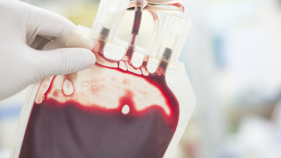 Šta se desi ako transfuzijom dobijete krv druge grupe