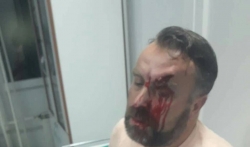 Stefan Cvetković tvrdi da je napadnut večeras u kafiću u Beloj Crkvi