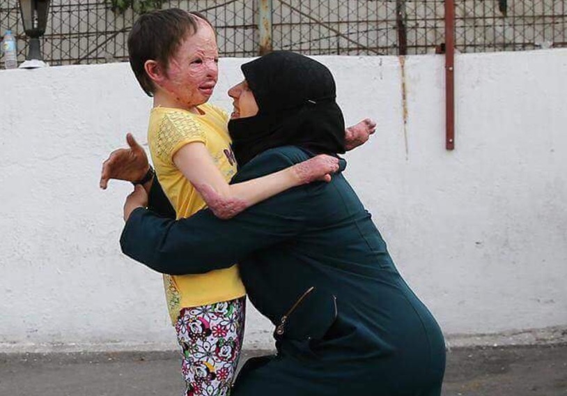 Stradala u bombardiranju ruske avijacije: Emotivan susret djevojčice sa roditeljima nakon liječenja u Turskoj