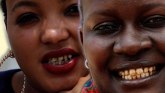Tanzanija i bolesti: Žuti zubi su mi uništili snove
