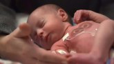 Tehnologija i medicina: Bežični flaster pomaže roditeljima da grle prevremeno rođenu bebu