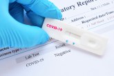 Teško je prepoznati infekciju: Broj obolelih od koronavirusa raste, da li ima mesta za paniku?