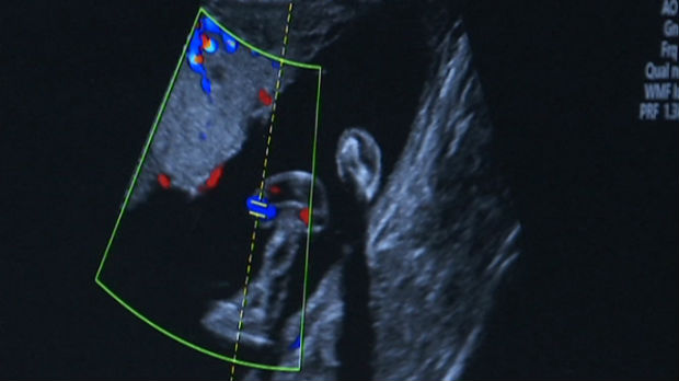 Trstenički Dom zdravlja dobio najsavremeniji 4D ultrazvučni aparat