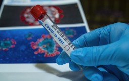 
					U BIH 35 novih žrtava koronavirusa, pozitivno više od polovine testiranih 
					
									