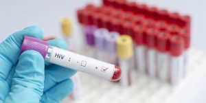 U Bačkoj Palanci nije registrovana ni jedna HIV pozitivna osoba