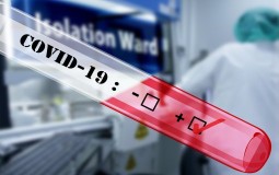 
					U BiH devet novih slučajeva koronavirusa 
					
									
