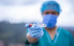 
					U Hrvatskoj rekordnih 369 novih slučajeva koronavirusa, tri osobe preminule 
					
									