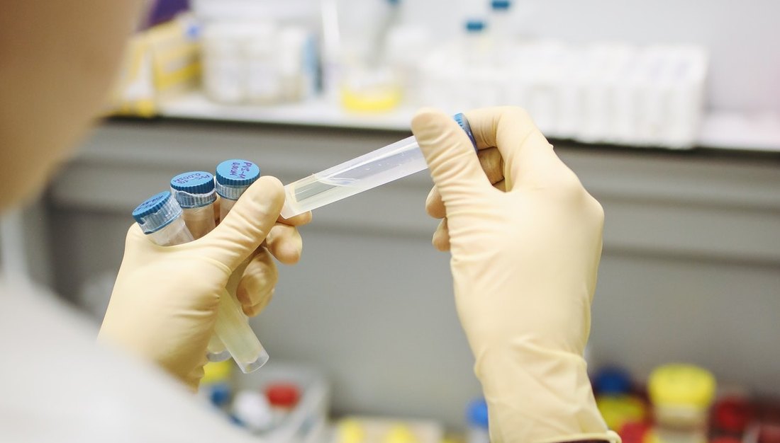 U Republici Srpskoj tri nova slučaja koronavirusa, preminula jedna osoba