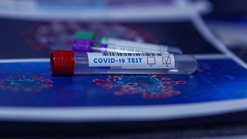 U Srbiji 468 novih slučajeva koronavirusa, preminula jedna osoba