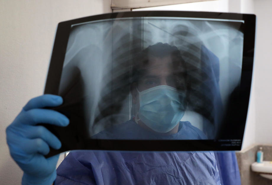 U Srbiji od raka pluća godišnje umre 4.600 ljudi