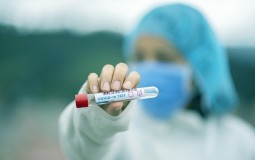 
					U Srbiji preminuo još četrdeset jedan pacijent, novozaraženih 7.579 
					
									