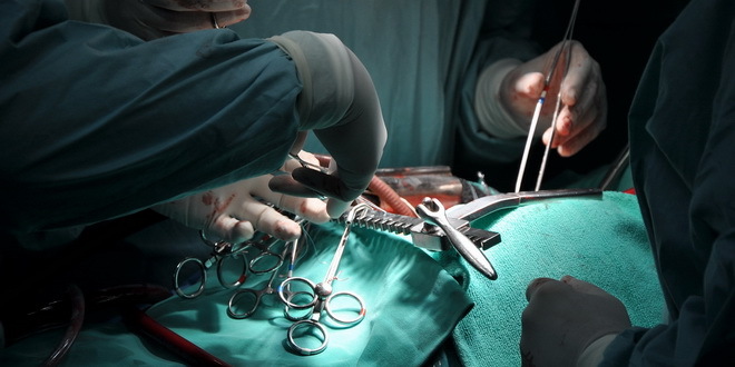 U Srbiji urađena prva transplantacija testisa, druga u svetu