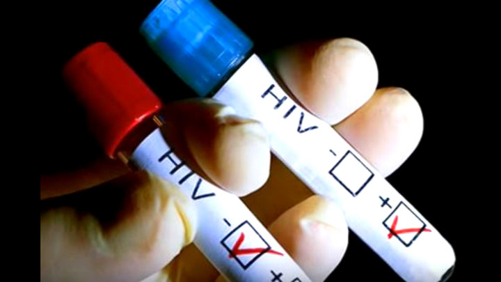 UNAIDS: Istočna Evropa i centralna Azija imaju porast broja novih infekcija HIV VIRUSOM za 29 odsto!