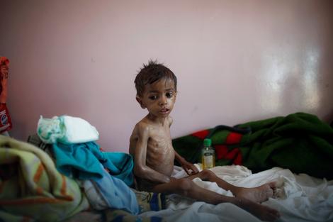 Unicef: U Jemenu ubijeno 1.400 dece