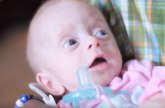 Usvojili bebu bez mozga: Ono što je ovaj par uradio će vam vratiti veru u ljude (VIDEO)