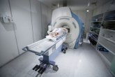 Uveden novi sistem zakazivanja: Prepolovljena lista čekanja za magnetnu rezonancu