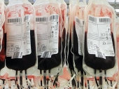 VB: Pacijentima davana zaražena krv, umrlo 2.400 ljudi