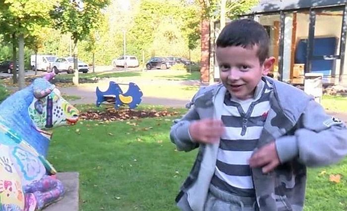 VIDEO: Dečak-leptir dobio potpuno novu kožu pomoću genske terapije