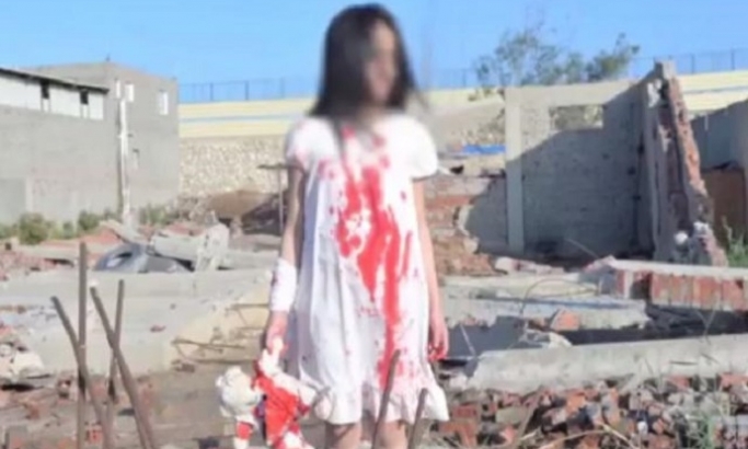 VIDEO: Krvavo dete iz Alepa je prevara čika Mustafe