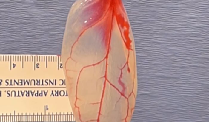 VIDEO: Pretvorili list spanaća u srčano tkivo