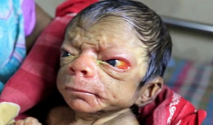 VIDEO: Rođena beba koja izgleda kao da ima 80 godina