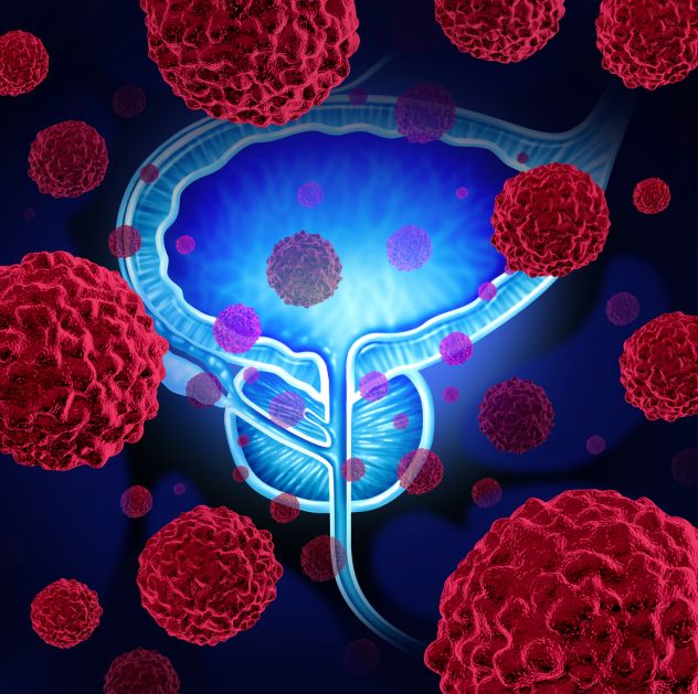 Veštačkom inteligencijom do dijagnoze raka prostate iz testa urina