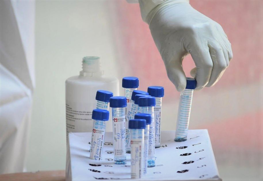 Vlada Srbije: U zalihama više od 260.000 PCR testova