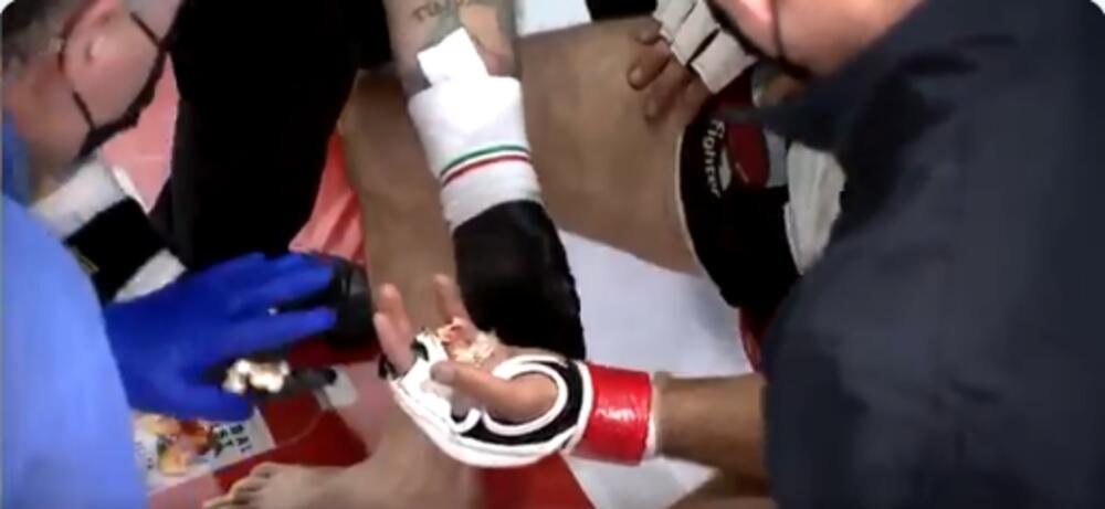 ZASTRAŠUJUĆA SCENA: MMA borac ostao bez prsta tokom borbe! UZNEMIRUJUĆI VIDEO
