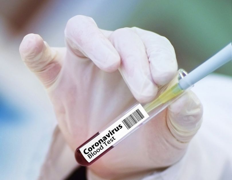Zabeleženi prvi slučajevi reinfekcije koronavirusom