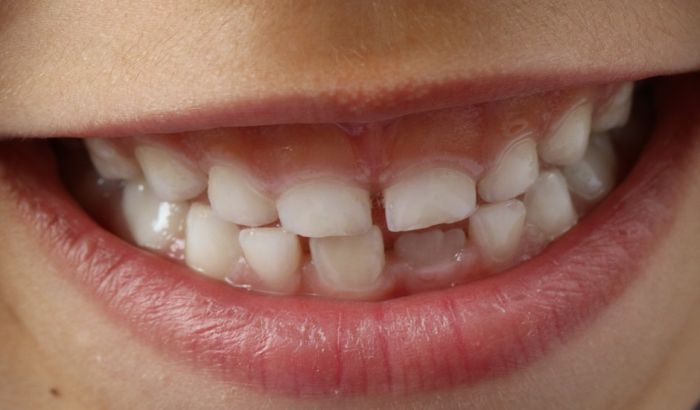 Zašto stalni zubi ne mogu ponovo da izrastu