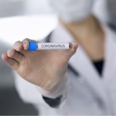 Zavod za biocide počinje da radi testove na korona virus: Radiće 1.000 nedeljno