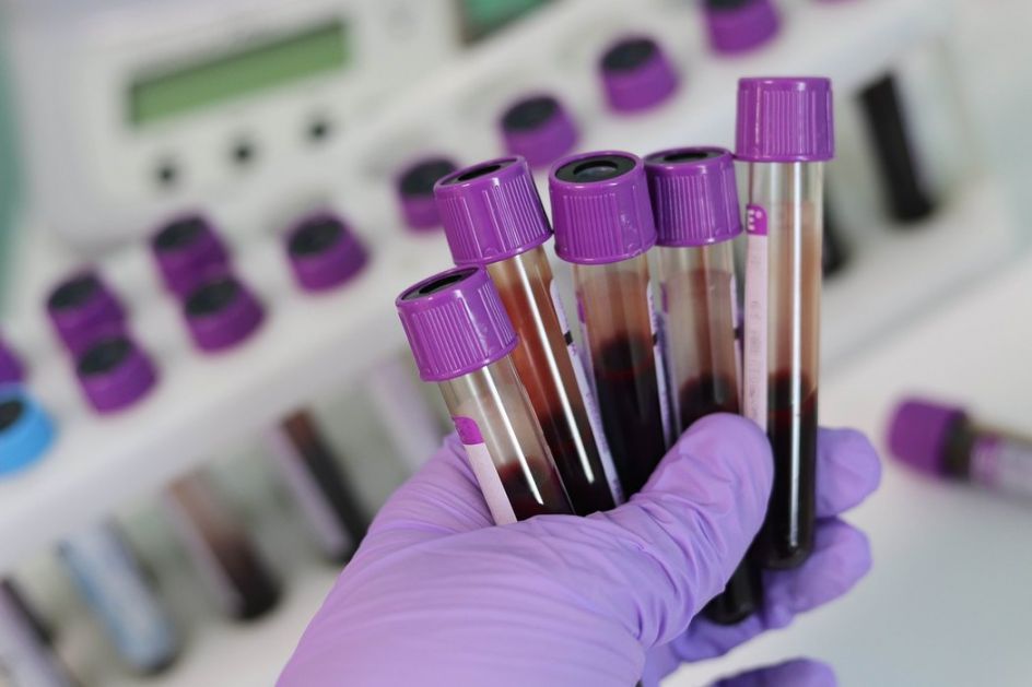 Zavod za transfuziju krvi Vojvodine organizuje dobrovoljno davanje krvi