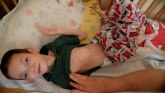 Zlostavljanje dece sa invaliditetom u Ukrajini: Tinejdžer vezan za krevet, odrasli koji spavaju u malim krevetima i neuhranjena deca
